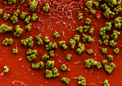 hzi wiss staph aureus mr 013 (c)hzi manfred rohde