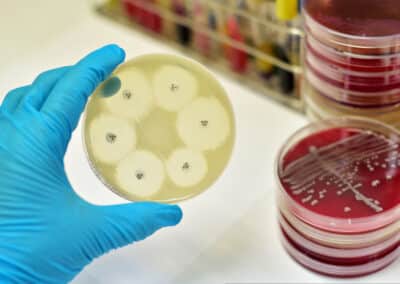 antimicrobial,susceptibility,testing,in,culture,plate
